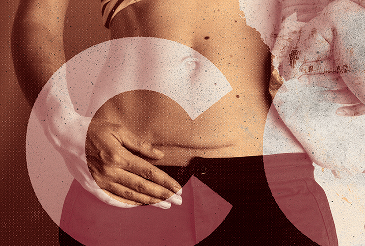 A woman with her stomach exposed, places her hand below a c-section scar and a large C covers the left side of the image.