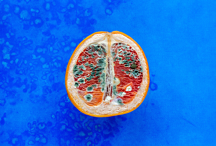 Half of an orange lays upright against a blue surface with discoloration and mold on it.