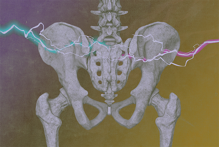 The pelvic region of a skeleton has teal and pink lighting bolts going across it against a cloudy purple and yellow background.