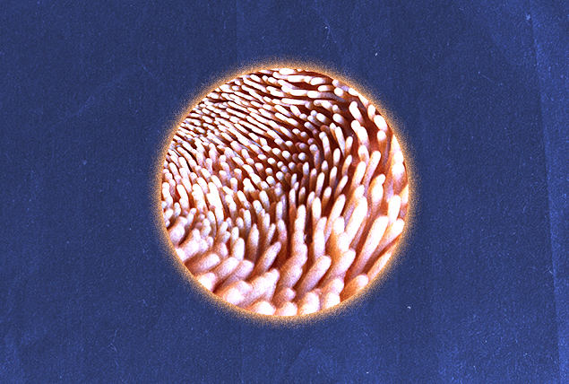 A circle in the middle of a blue background shows the lining of the intestines.