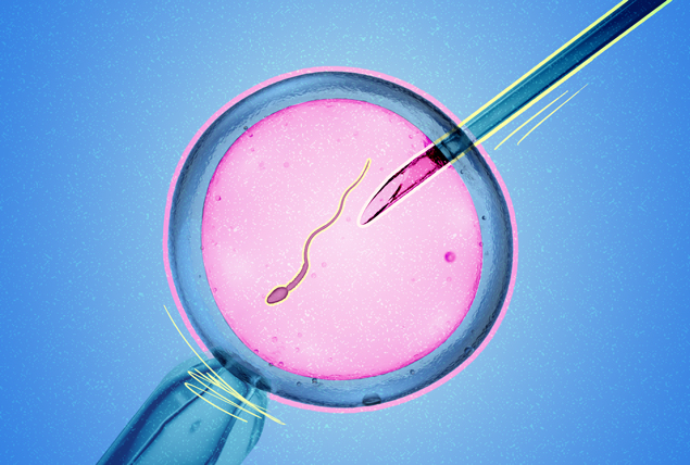 A needle sticks a sperm into an embryo.