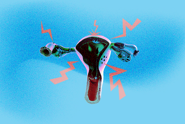 twisted up uterus with red zigzags surrounding it on a blue background