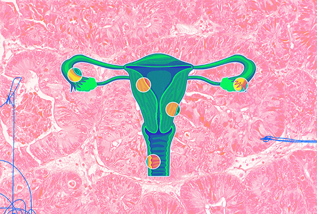 A green female reproductive system has yellow dots around different parts of it against pink background.