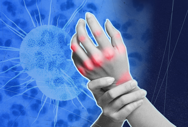 A person holds their wrist as their joints flare up in red against a background of blue cells.