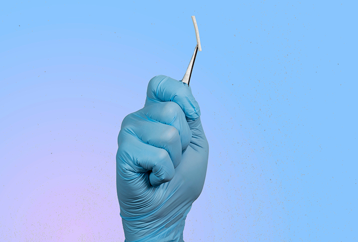 A hand inside of a surgical glove holds a birth control implant between a pair of tweezers.