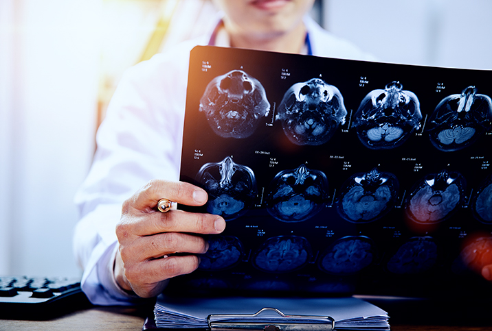 A doctor looks over a CT scan image which uses contrast dye to produce.