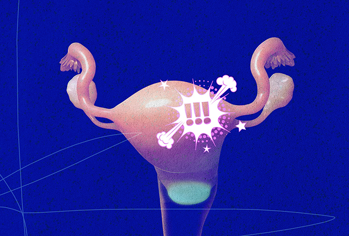 The female reproductive system sits against a blue background as a white cloud with three exclamation points hovers over it.