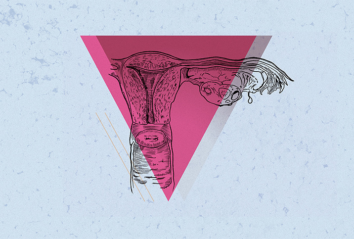 One side of the female reproductive system has a pink, upside-down triangle over top.