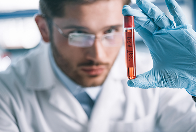 A doctor examines a vial sample from a PSA test.