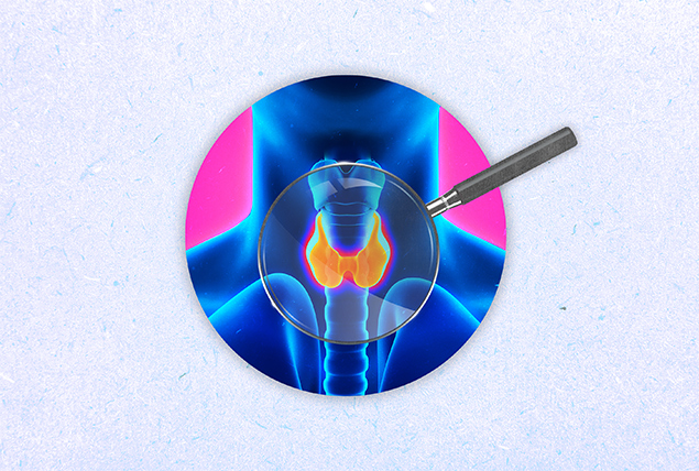 An x-ray of a human neck shows the thyroid highlighted in orange.